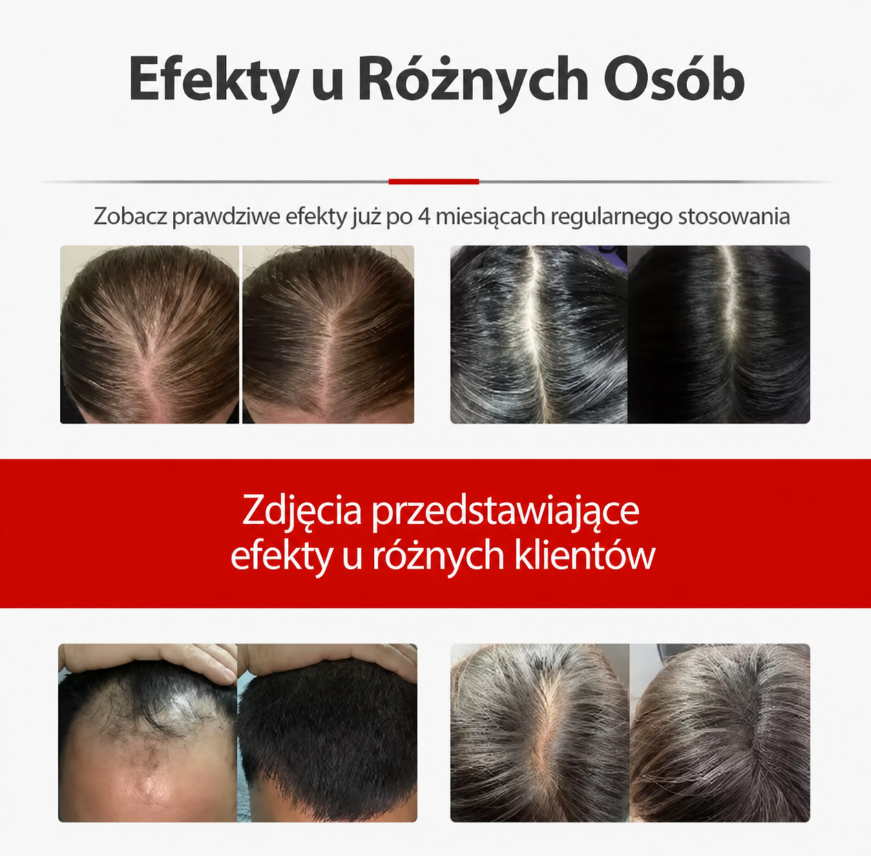 CZAPKA LED NA POROST WŁOSÓW – WSPARCIE DLA GĘSTSZYCH I MOCNIEJSZYCH WŁOSÓW 🔴