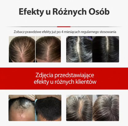 CZAPKA LED NA POROST WŁOSÓW – WSPARCIE DLA GĘSTSZYCH I MOCNIEJSZYCH WŁOSÓW 🔴